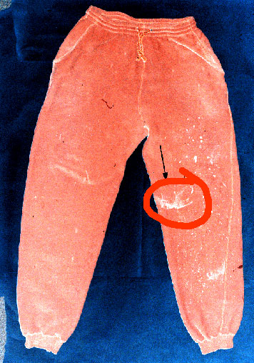 pants inverted